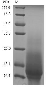 AQP4 / Aquaporin 4 Protein - (Tris-Glycine gel) Discontinuous SDS-PAGE (reduced) with 5% enrichment gel and 15% separation gel.The reducing (R) protein migrates as 16 kDa in SDS-PAGE may be due to glycosylation.