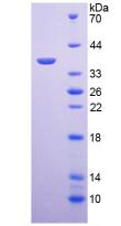 ARG1 / Arginase 1 Protein - Recombinant Arginase By SDS-PAGE