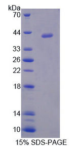 ARH / LDLRAP1 Protein - Recombinant Low Density LiPoprotein Receptor Adaptor Protein 1 By SDS-PAGE