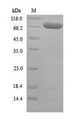 ARID5A Protein - (Tris-Glycine gel) Discontinuous SDS-PAGE (reduced) with 5% enrichment gel and 15% separation gel.