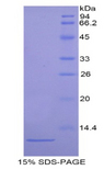 ARPC4 Protein - Recombinant Actin Related Protein 2/3 Complex Subunit 4 By SDS-PAGE