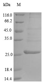 ARTS1 / ERAP1 Protein - (Tris-Glycine gel) Discontinuous SDS-PAGE (reduced) with 5% enrichment gel and 15% separation gel.