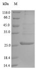 ARTS1 / ERAP1 Protein - (Tris-Glycine gel) Discontinuous SDS-PAGE (reduced) with 5% enrichment gel and 15% separation gel.