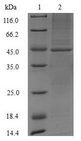 ASAH1 / Acid Ceramidase Protein - (Tris-Glycine gel) Discontinuous SDS-PAGE (reduced) with 5% enrichment gel and 15% separation gel.