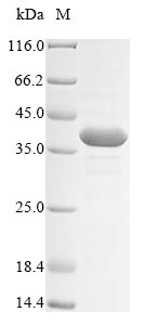 ASCL2 Protein - (Tris-Glycine gel) Discontinuous SDS-PAGE (reduced) with 5% enrichment gel and 15% separation gel.
