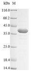 ASCL2 Protein - (Tris-Glycine gel) Discontinuous SDS-PAGE (reduced) with 5% enrichment gel and 15% separation gel.