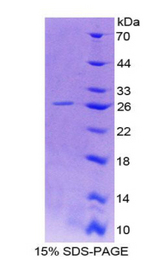 ASGR1 / ASGPR Protein - Recombinant Asialoglycoprotein Receptor 1 By SDS-PAGE