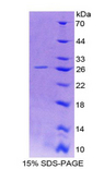 ASGR1 / ASGPR Protein - Recombinant Asialoglycoprotein Receptor 1 By SDS-PAGE