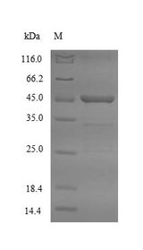 ASGR2 Protein - (Tris-Glycine gel) Discontinuous SDS-PAGE (reduced) with 5% enrichment gel and 15% separation gel.