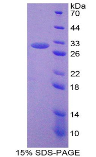 ATF1 Protein - Recombinant Activating Transcription Factor 1 By SDS-PAGE
