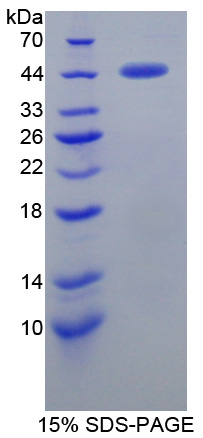 ATF6 Protein - Recombinant  Activating Transcription Factor 6 By SDS-PAGE