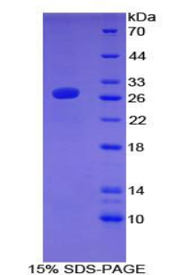 ATF7 Protein - Recombinant Activating Transcription Factor 7 By SDS-PAGE