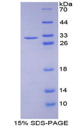 ATXN1 / SCA1 Protein - Recombinant Ataxin 1 By SDS-PAGE