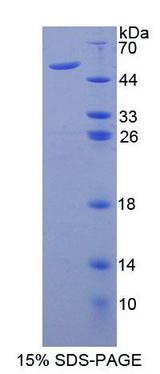 AUP1 Protein - Recombinant Ancient Ubiquitous Protein 1 By SDS-PAGE