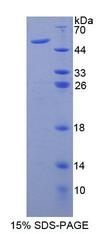AUP1 Protein - Recombinant Ancient Ubiquitous Protein 1 By SDS-PAGE