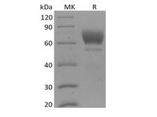 AXL Protein - Recombinant Mouse Tyrosine-protein kinase receptor UFO/AXL oncogene/UFO (C-6His)