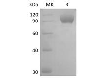 AXL Protein - Recombinant Mouse Tyrosine-protein kinase receptor UFO/AXL oncogene/UFO (C-FC)