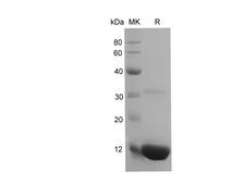 B2M / Beta 2 Microglobulin Protein - Recombinant Mouse B2M/ß2-MG Protein (His Tag)-Elabsicence