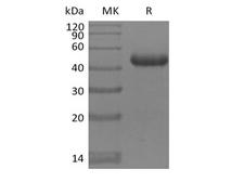 BAFF Receptor / CD268 Protein - Recombinant Mouse BAFFR/TNFRSF13C (C-Fc)