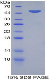 BAFF Receptor / CD268 Protein - Recombinant B-Cell Activation Factor Receptor By SDS-PAGE