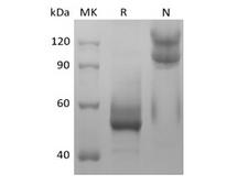 BAFF / TNFSF13B Protein - Recombinant Mouse TNFSF13B/BAFF/CD257 (N-mFc)