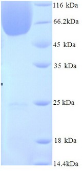 BAG3 / BAG-3 Protein