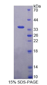 BAG4 / SODD Protein - Recombinant Bcl2 Associated Athanogene 4 (BAG4) by SDS-PAGE
