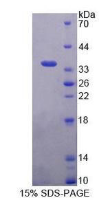 BAG4 / SODD Protein - Recombinant Bcl2 Associated Athanogene 4 (BAG4) by SDS-PAGE