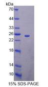 BAG5 Protein - Recombinant Bcl2 Associated Athanogene 5 (BAG5) by SDS-PAGE