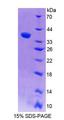 Band 4.1 / EPB41 Protein - Recombinant Erythrocyte Membrane Protein Band 4.1 By SDS-PAGE