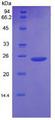 BAX Protein - Recombinant Bcl2 Associated X Protein By SDS-PAGE