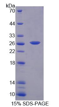 BCAT1 / ECA39 Protein - Recombinant Branched Chain Aminotransferase 1, Cytosolic (BCAT1) by SDS-PAGE