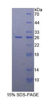 BCL2 / Bcl-2 Protein - Recombinant B-Cell Leukemia/Lymphoma 2 By SDS-PAGE