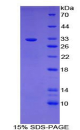 BCL3 / BCL-3 Protein - Recombinant B-Cell CLL/Lymphoma 3 By SDS-PAGE