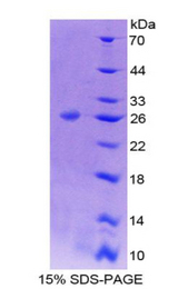 BCL9 Protein - Recombinant B-Cell CLL/Lymphoma 9 By SDS-PAGE