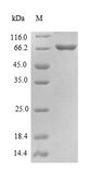 BECN1 / Beclin-1 Protein - (Tris-Glycine gel) Discontinuous SDS-PAGE (reduced) with 5% enrichment gel and 15% separation gel.