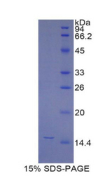 Beta-N-Acetylglucosaminidase Protein - Recombinant N-Acetyl Beta-D-Glucosaminidase By SDS-PAGE