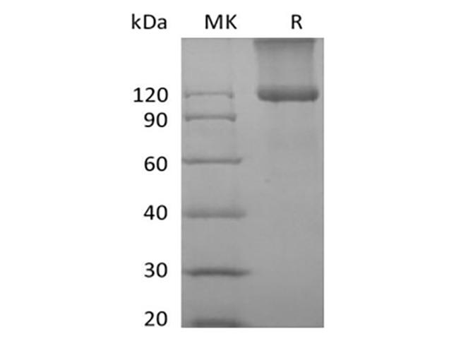Betaglycan / TGFBR3 Protein - Recombinant Mouse TGFBR3 (C-6His)