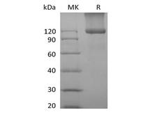 Betaglycan / TGFBR3 Protein - Recombinant Mouse TGFBR3 (C-6His)
