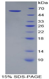 Betaglycan / TGFBR3 Protein - Recombinant Transforming Growth Factor Beta Receptor III By SDS-PAGE