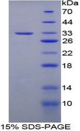 BIRC1 / NAIP Protein - Recombinant Neuronal Apoptosis Inhibitory Protein By SDS-PAGE