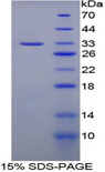 BIRC1 / NAIP Protein - Recombinant Neuronal Apoptosis Inhibitory Protein By SDS-PAGE
