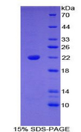 BLMH Protein - Recombinant Bleomycin Hydrolase By SDS-PAGE