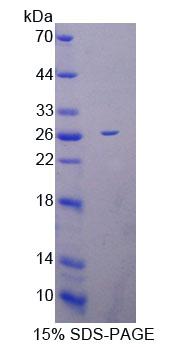 BM022 / MRPL1 Protein - Recombinant Mitochondrial Ribosomal Protein L1 By SDS-PAGE