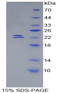 BMP1 Protein - Recombinant Bone Morphogenetic Protein 1 By SDS-PAGE