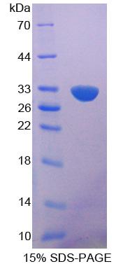 BMPER Protein - Recombinant BMP Binding Endothelial Regulator By SDS-PAGE