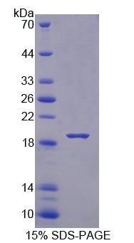 BPGM Protein - Recombinant Bisphosphoglycerate Mutase (BPGM) by SDS-PAGE