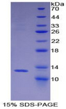 BRAK / CXCL14 Protein - Recombinant Breast And Kidney Expressed Chemokine By SDS-PAGE