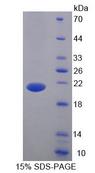 BTLA / CD272 Protein - Recombinant B And T-Lymphocyte Attenuator By SDS-PAGE