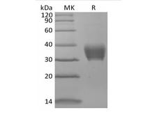 BTN3A3 Protein - Recombinant Mouse BTNL4 (C-6His)